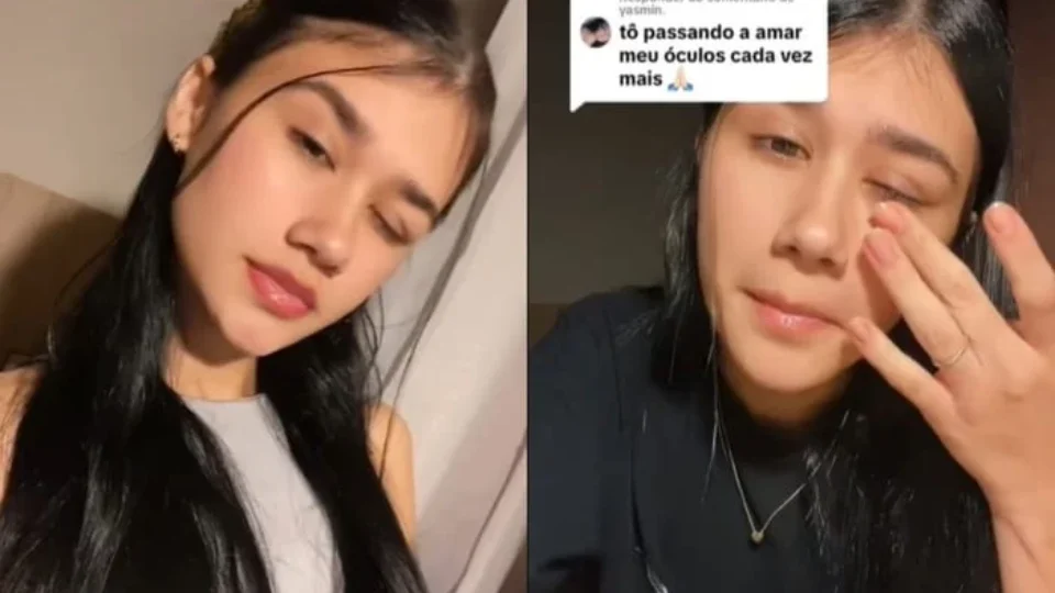 Jovem fica cega e entra na fila do transplante por mau uso de lente