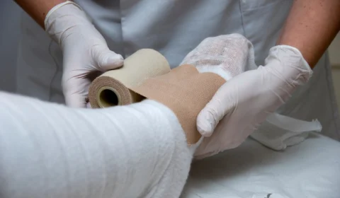 Junho Laranja: saiba mais sobre cuidados e prevenção às queimaduras