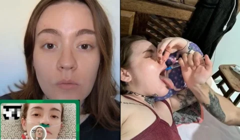 Influenciadora que tem neuralgia do trigêmeo abre vaquinha para fazer eutanásia no exterior