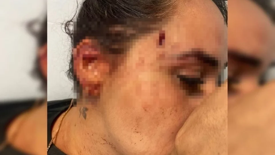 Mulher quebra copo no rosto de aniversariante dentro de bar