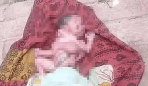 VEJA; Bebê nasce com quatro braços, quatro pernas e dois rostos na Índia