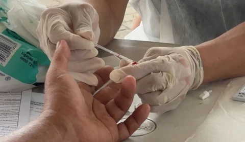 Julho Amarelo: Saúde reforça Campanha de Prevenção às Hepatites Virais