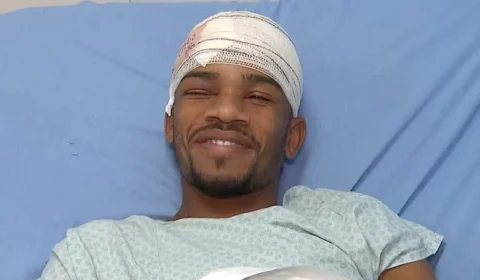 Carpinteiro que teve cabeça perfurada por estacada de madeira recebe alta