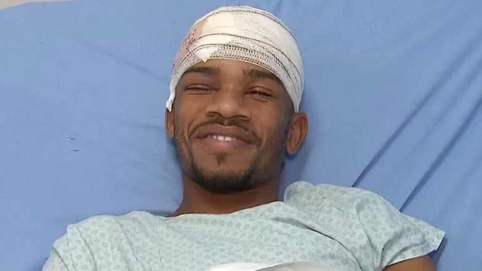 Carpinteiro que teve cabeça perfurada por estacada de madeira recebe alta