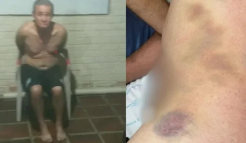 Paciente morre após tortura em clínica de reabilitação na Grande São Paulo; Veja vídeo