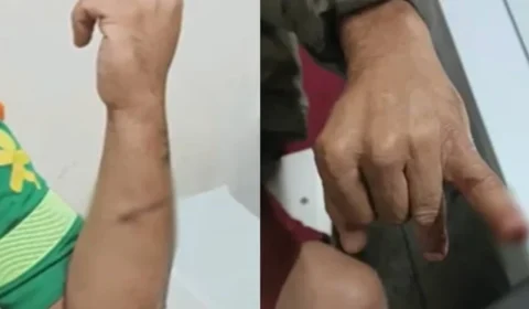 Briga entre ‘compadres’ antes de batizado acaba com facada e mordida