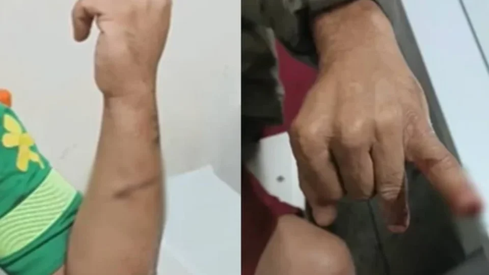 Briga entre ‘compadres’ antes de batizado acaba com facada e mordida