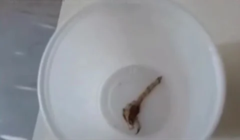 VEJA VÍDEO: filha de paciente encontra escorpião dentro da fralda do pai em hospital