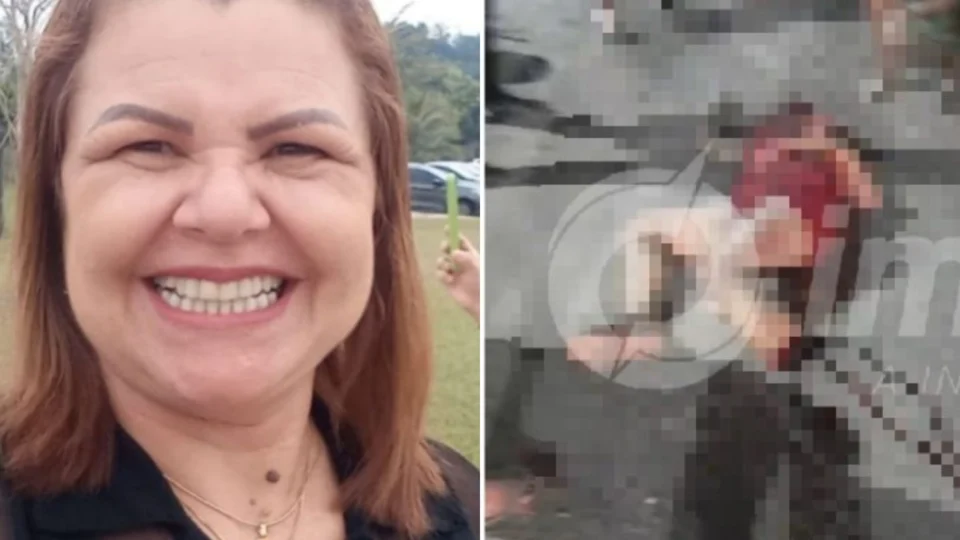 Mulher que teve perna ‘torada’ em acidente na Compensa morre em hospital