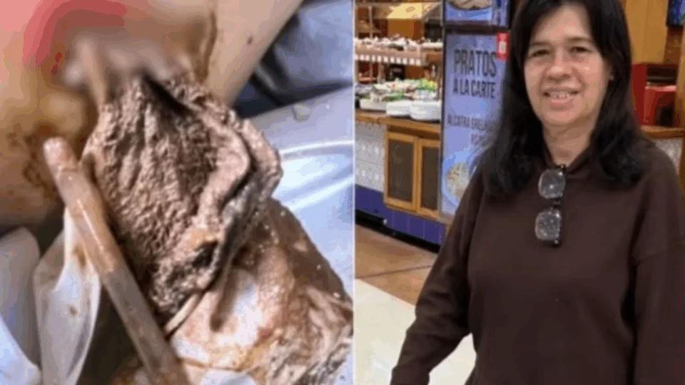 Mulher descobre pano de 20 cm esquecido dentro do corpo após cirurgia