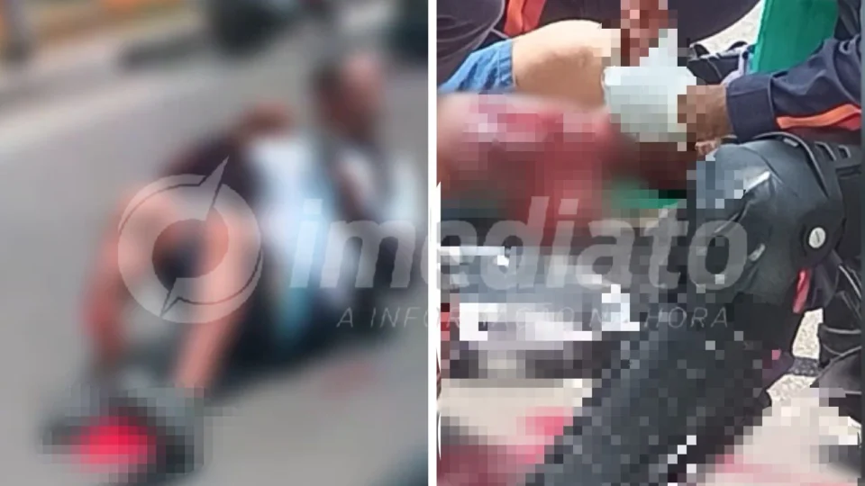 VÍDEO: motociclista colide em traseira de carro e fica com fratura exporta na Avenida das Torres