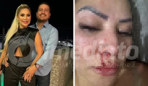 Candidato à prefeito em Bonfim-RR agride companheira