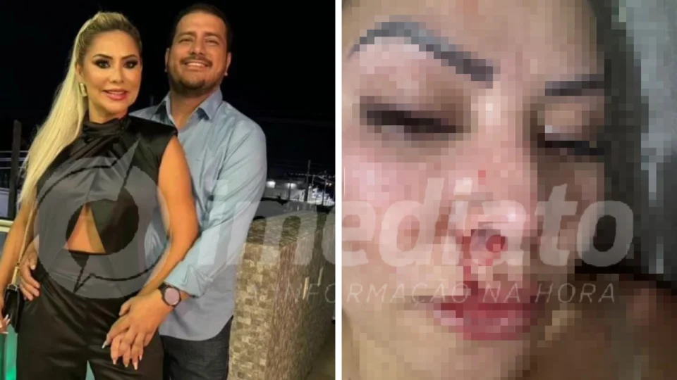 Candidato à prefeito em Bonfim-RR agride companheira