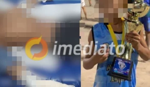 IMAGENS FORTES: veja como ficou mãos do menino de 10 anos que teve dedos decepados por facção em Manaus