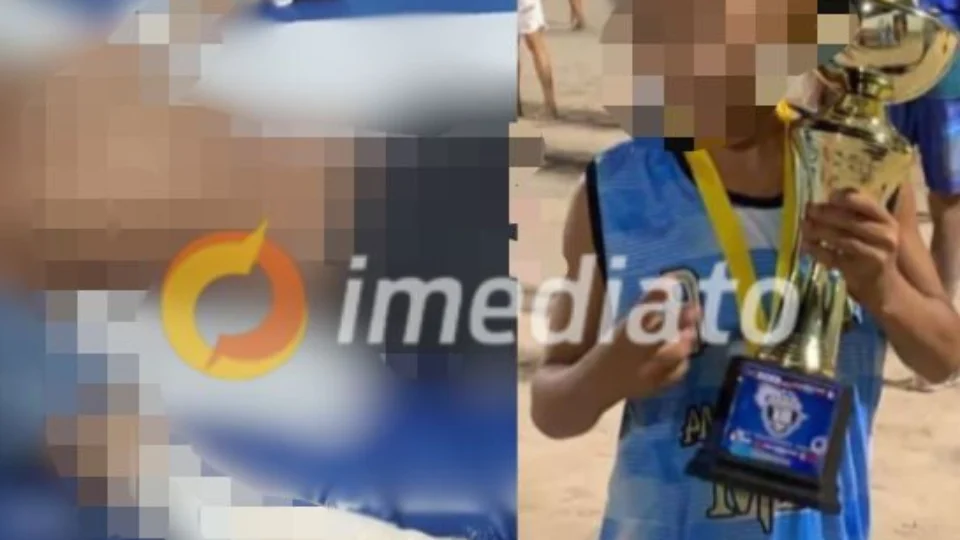 IMAGENS FORTES: veja como ficou mãos do menino de 10 anos que teve dedos decepados por facção em Manaus