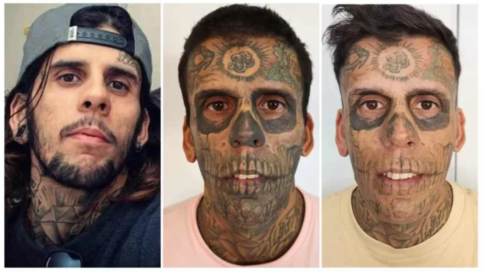 Agora evangélico, ‘homem mais tatuado do Brasil’ começa a remover tatuagens