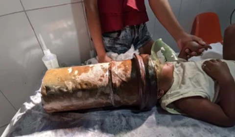 VEJA VÍDEO: criança de 2 anos fica com a cabeça presa em tubo de aço