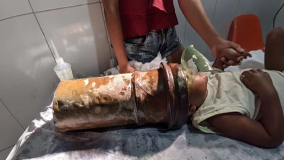 VEJA VÍDEO: criança de 2 anos fica com a cabeça presa em tubo de aço