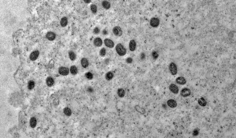 Mpox: Argentina põe em quarentena navio que deixou Brasil