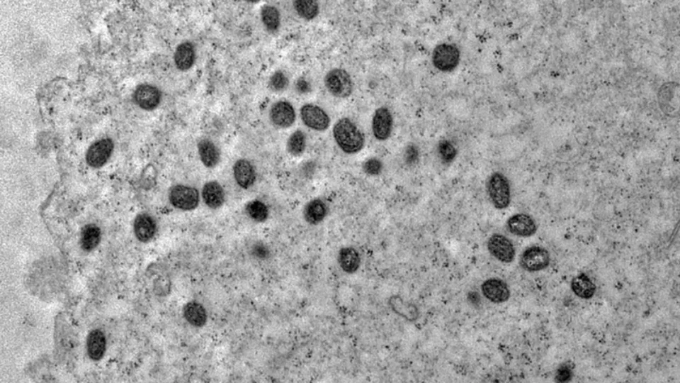 Mpox: Argentina põe em quarentena navio que deixou Brasil