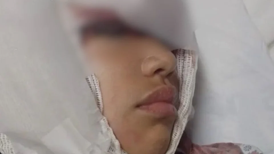 VEJA VÍDEO: menina fica gravemente ferida e perde couro cabeludo em parquinho