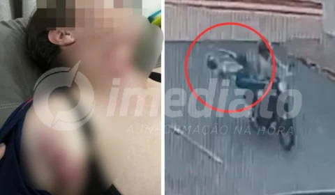 Veja Vídeo: fio solto corta pescoço e derruba mulher da garupa de moto