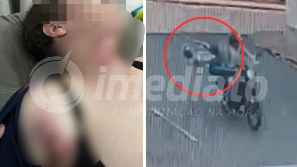 Veja Vídeo: fio solto corta pescoço e derruba mulher da garupa de moto