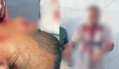Homem tem parte da orelha arrancada com mordida durante discussão sobre política