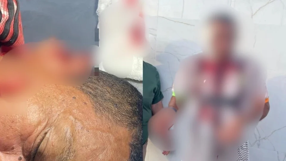 Homem tem parte da orelha arrancada com mordida durante discussão sobre política