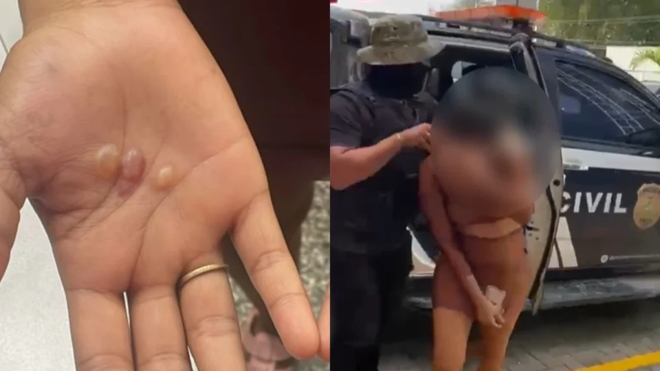 Fotos: mulher torturava adolescente de 12 anos com plástico derretido e alumínio quente em Manaus