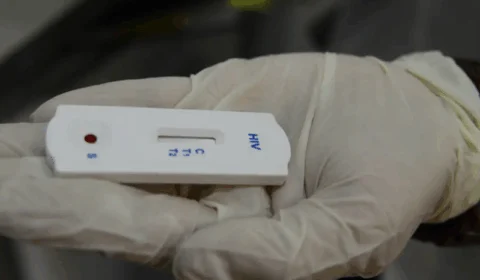 Seis pacientes testam positivo para o vírus HIV após passarem por transplante