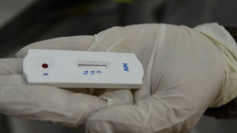 Seis pacientes testam positivo para o vírus HIV após passarem por transplante