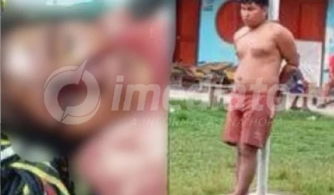 VEJA VÍDEO: homem é capturado após arrancar olho de ex-companheira com facão