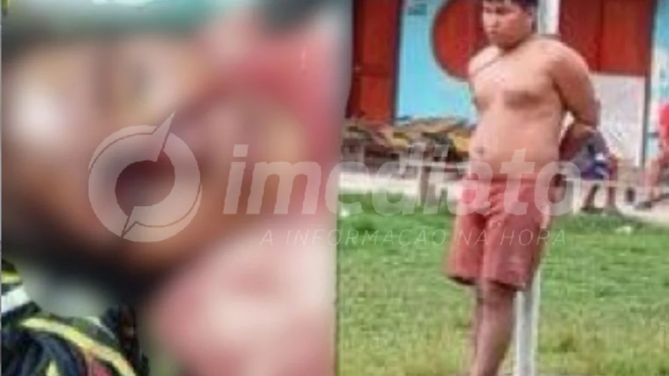 VEJA VÍDEO: homem é capturado após arrancar olho de ex-companheira com facão