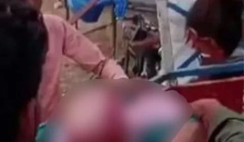 VEJA VÍDEO: adolescente têm couro cabeludo arrancado após cabelo ficar preso em roda gigante