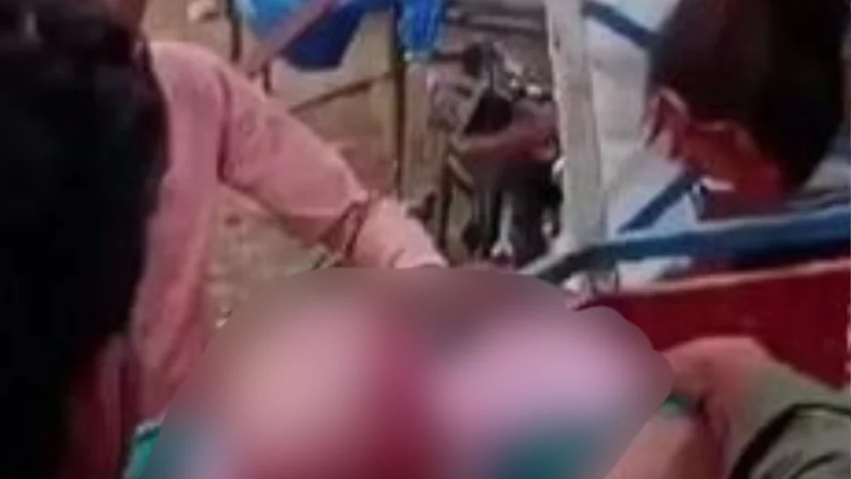 VEJA VÍDEO: adolescente têm couro cabeludo arrancado após cabelo ficar preso em roda gigante