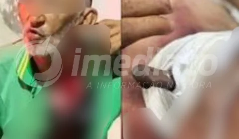 VEJA VÍDEO: idoso fica com faca cravada no pescoço após sofrer tentativa de homicídio