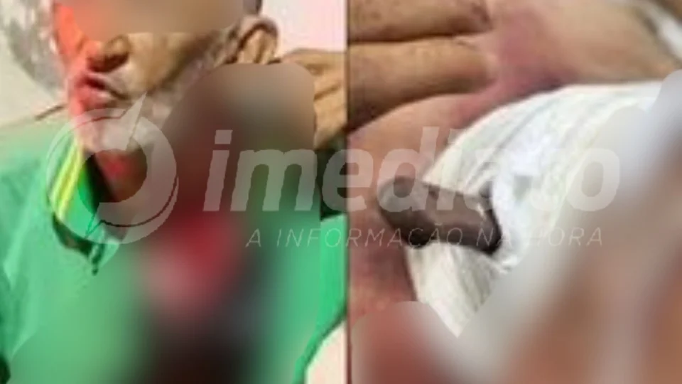 VEJA VÍDEO: idoso fica com faca cravada no pescoço após sofrer tentativa de homicídio