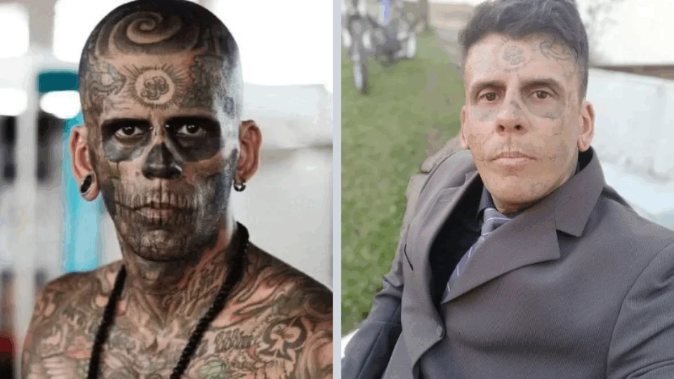 VÍDEO: agora evangélico, homem ‘mais tatuado do Brasil’ passa por remoção dos desenhos