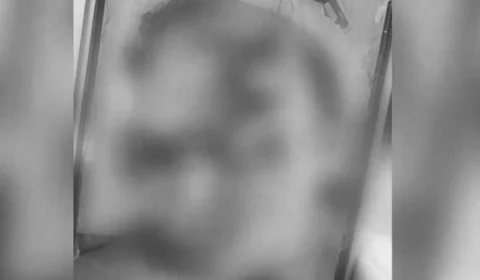 Jovem fica com rosto desfigurado após ser espancado em confraternização