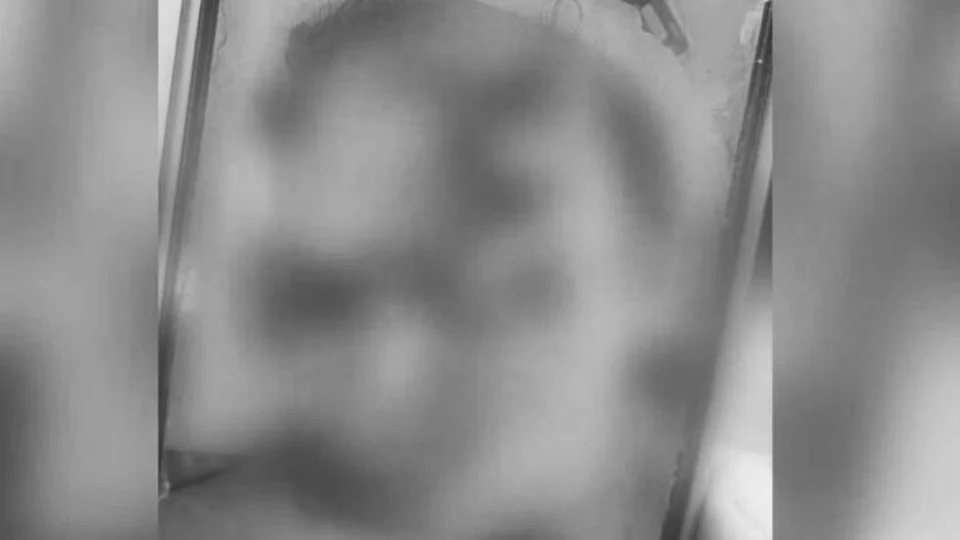 Jovem fica com rosto desfigurado após ser espancado em confraternização