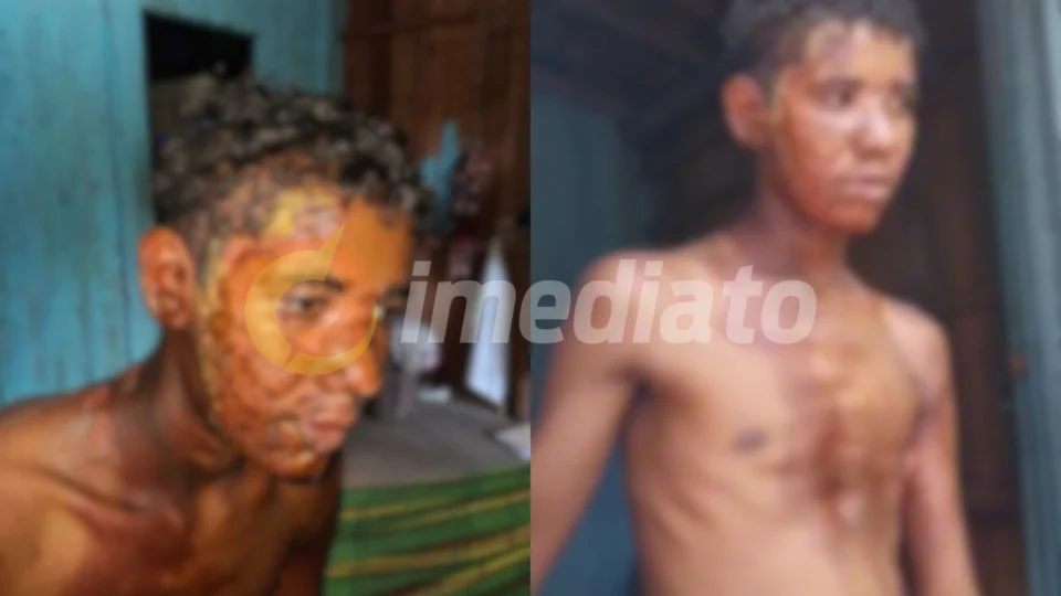 Vídeo: Madrasta é acusada de jogar água quente  com necessidades especiais