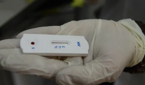 A cada 15 minutos, uma pessoa é infectada pelos vírus HIV no Brasil