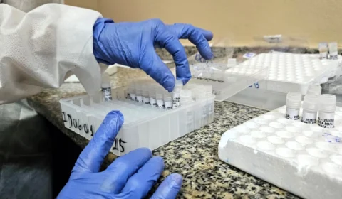 Amazonas registra 7 óbitos por SRAG nas primeiras sete semanas de 2025