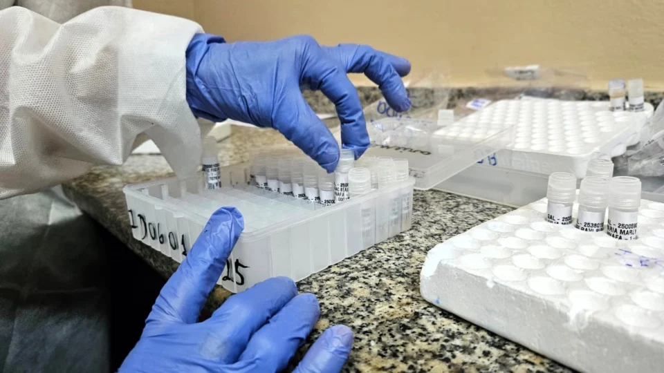 Amazonas registra 7 óbitos por SRAG nas primeiras sete semanas de 2025