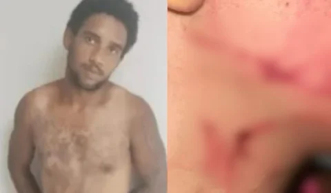 Homem tenta estrangular mulher e diz à polícia que queria beber sangue dela