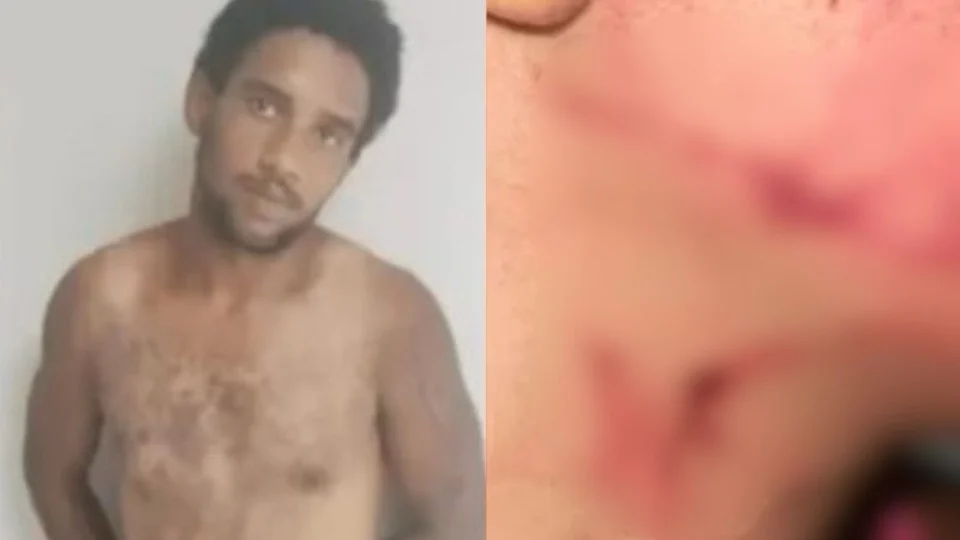 Homem tenta estrangular mulher e diz à polícia que queria beber sangue dela