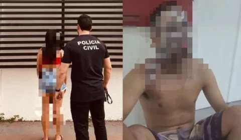 Após discussão e agressão, mulher queima rosto do marido com água quente