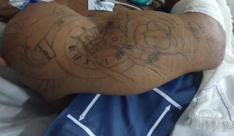 HPS João Lúcio pede ajuda para localizar familiares de paciente internado