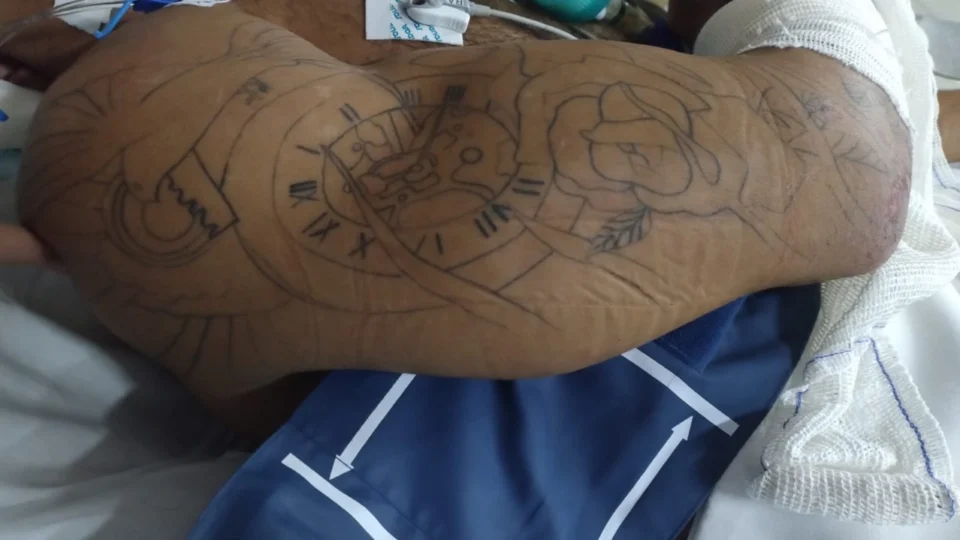 HPS João Lúcio pede ajuda para localizar familiares de paciente internado